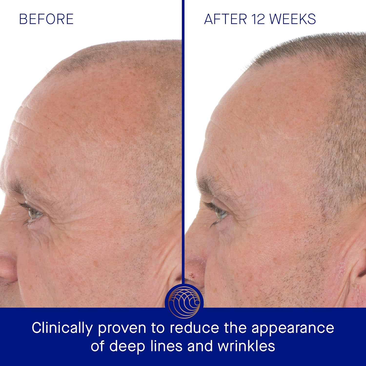 Augustinus Bader The Retinol Serum bottle